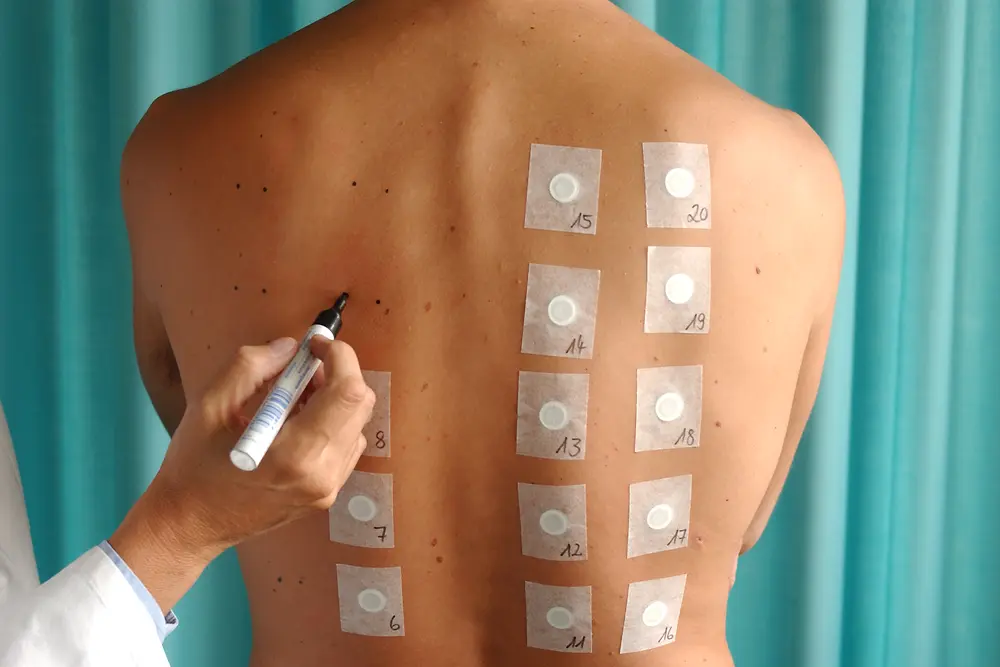 Test di compatibilità della pelle