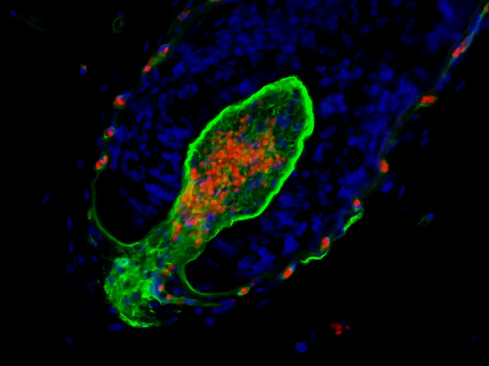 
Dermale Papille in der Haarwurzel