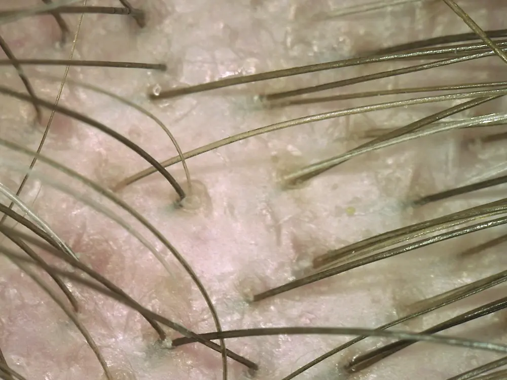 
Ein Blick auf die Kopfhaut